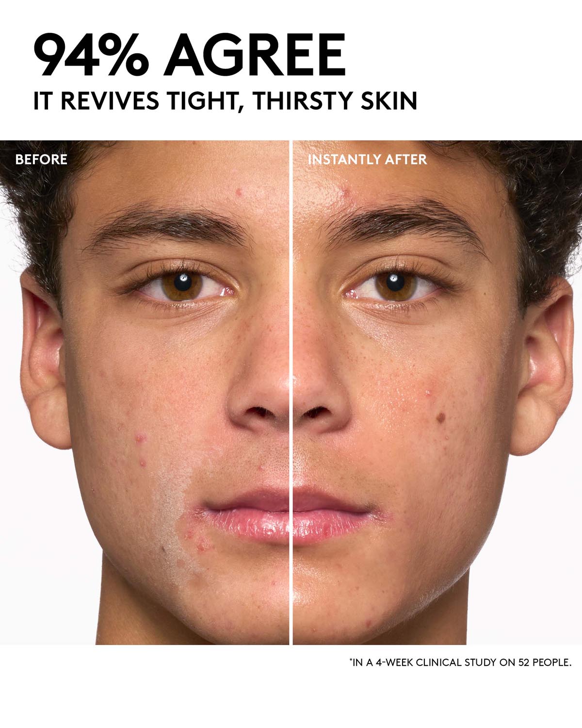 Day + Night Hydrating Routine: Dew N Plump Serum + Slushie Mask - Image 5