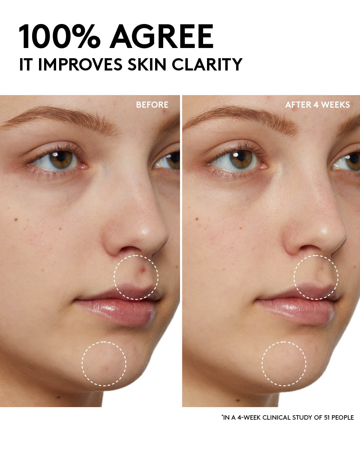 Cherry Dub Pore Purify'r Gel Cleanser with Niacinamide + Aloe Juice - Image 5