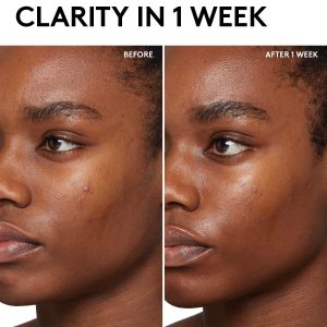 Alternative view of Cherry Dub BHA Toner with Salicylic Acid + Aloe Juice