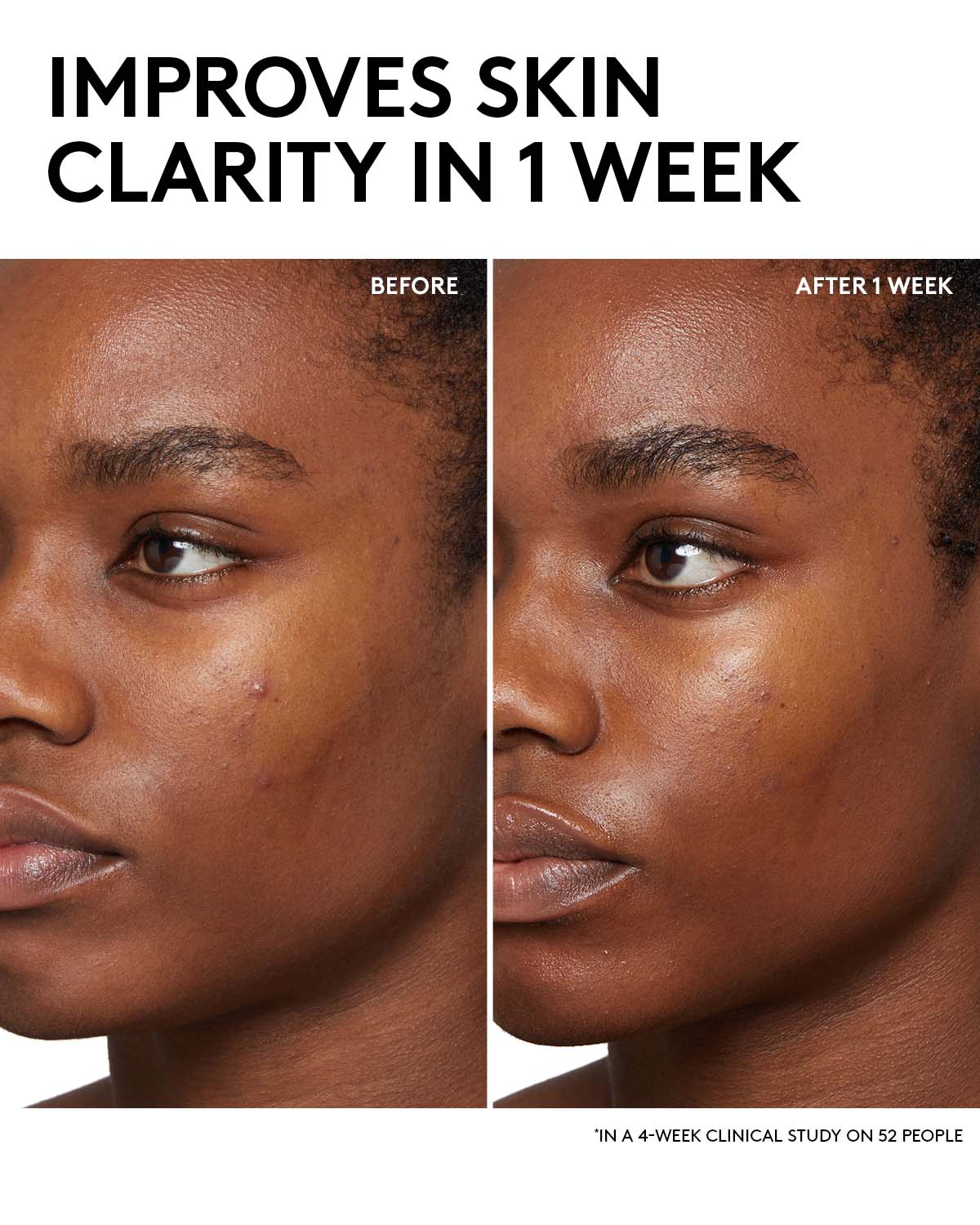 Cherry Dub BHA Toner with Salicylic Acid + Aloe Juice - Image 2